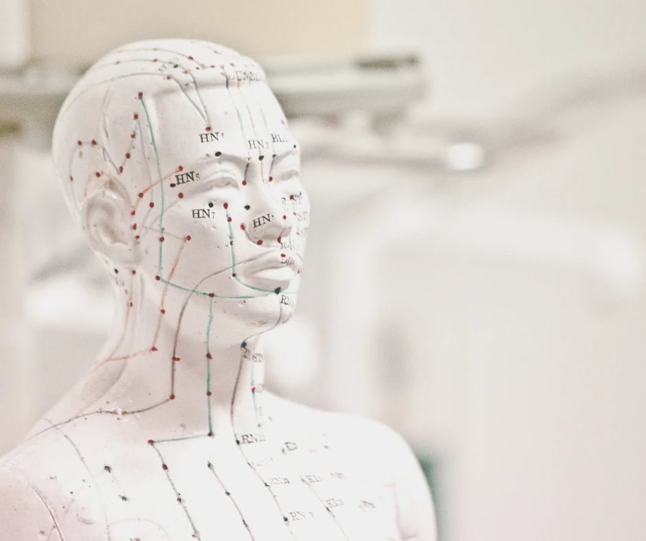 SIND Akupunktur model med akupunkturpunkter hos Klinik Ro og Velvære